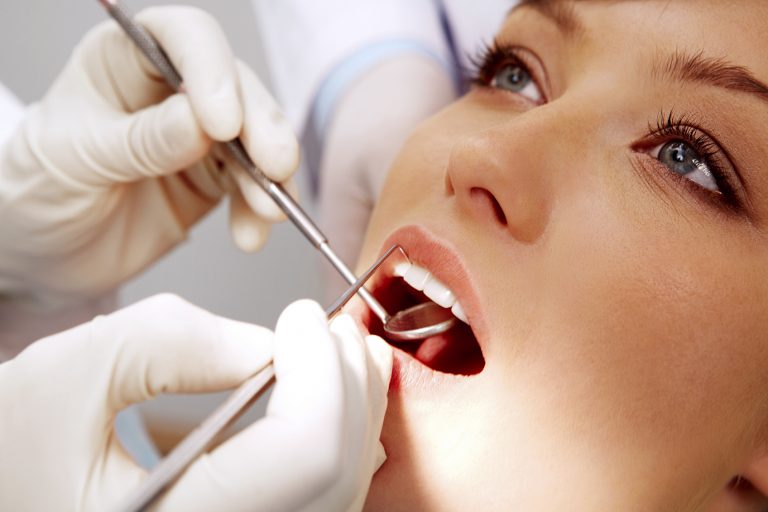 Can Dental Fillings Treat Tooth Decay? - Arc Advanced Dentistry