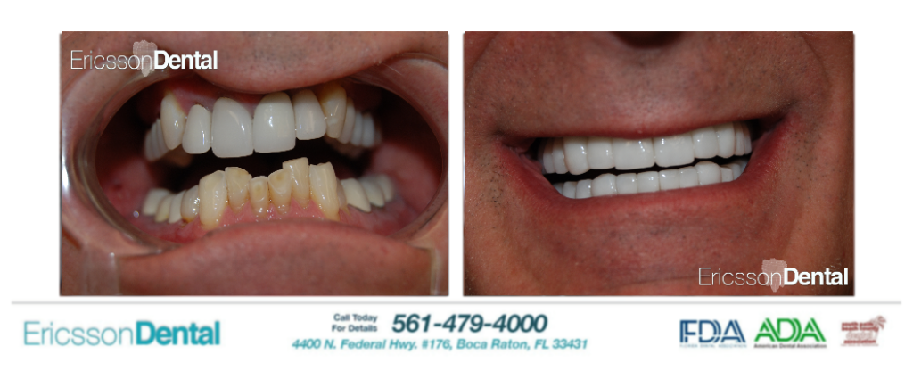 tmj dentist boca raton